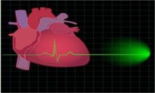 زنان، سلامتی و سکته قلبی