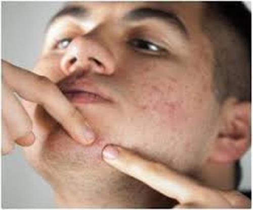 اینها را بخورید تا جوش نزنید